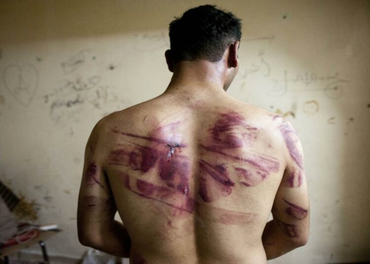 تقرير:أكثر من 11 ألفاً قتلهم النظام السوري تحت التعذيب