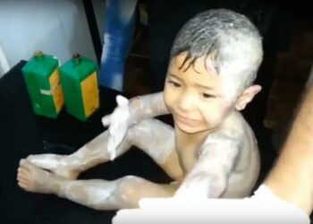 الموت حرقاً.. النابالم الروسي يلتهم أجساد المدنيين السوريين